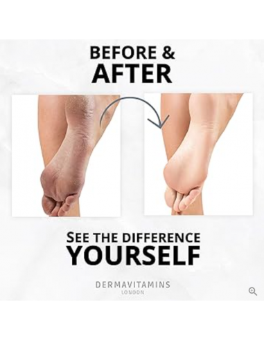Dermavitamins - Zaawansowana maska do stóp - regeneruje suche stopy