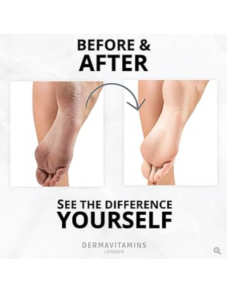 Dermavitamins - Zaawansowana maska do stóp - regeneruje suche stopy